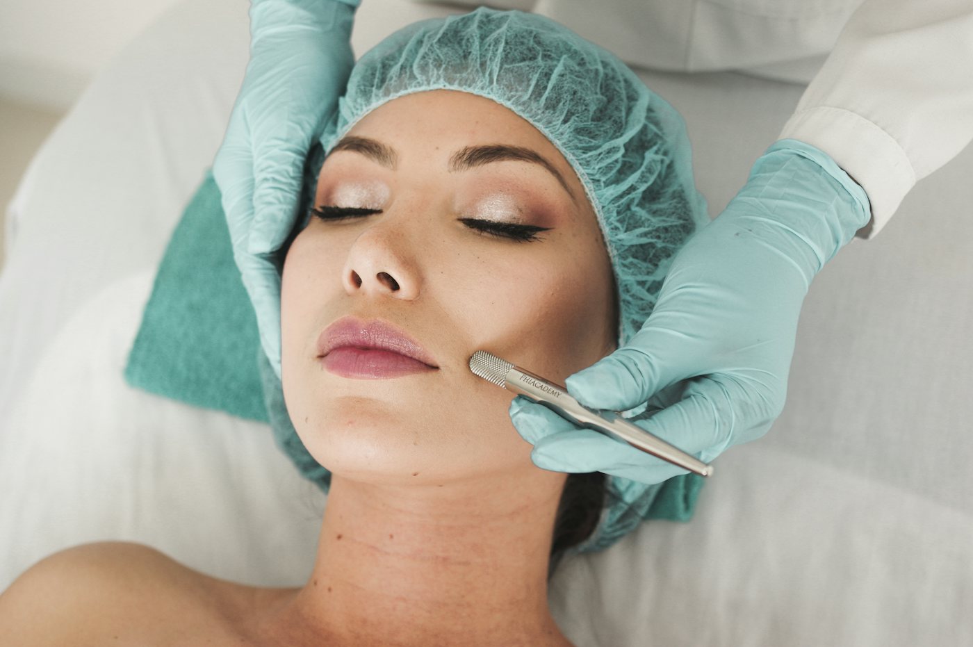 Tratamiento facial para acné en CDMX